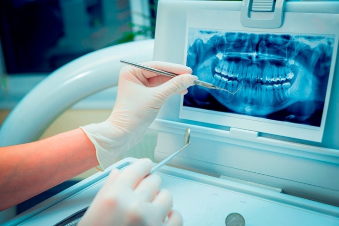 Despre-radiații-Stomatologie-Râmnicu-Sărat Despre-radiații-Stomatologie-Râmnicu-Sărat Radiații Râmnicu Sărat despre radiații Despre radiații – Ce trebuie să știe pacientul? Despre radia ii Stomatologie R mnicu S rat