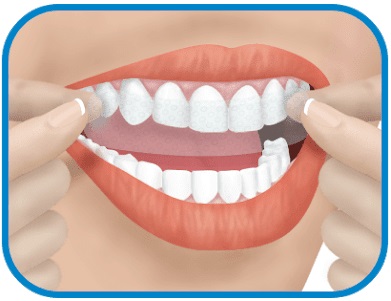 albire-dinti albire-dinti Albirea dentară albirea dentară Albirea dentară – Soluții pentru o dantură strălucitoare albire dinti